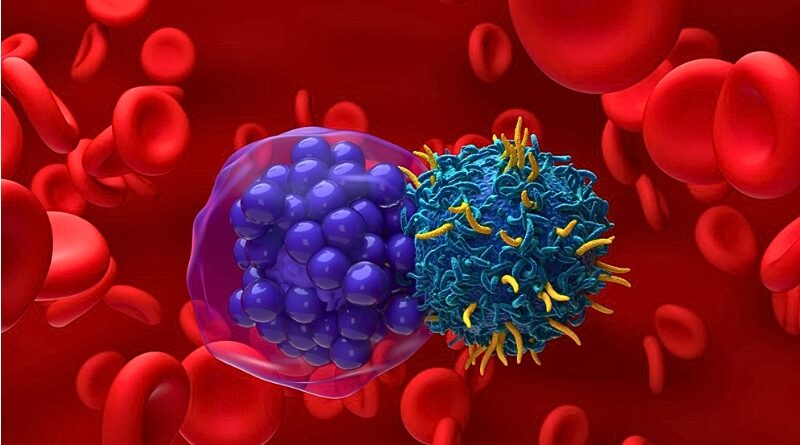 Científicos desarrollan una terapia celular de bajo coste que reduce el tiempo de tratamiento de semanas a 72 horas, con resultados prometedores en mieloma múltiple